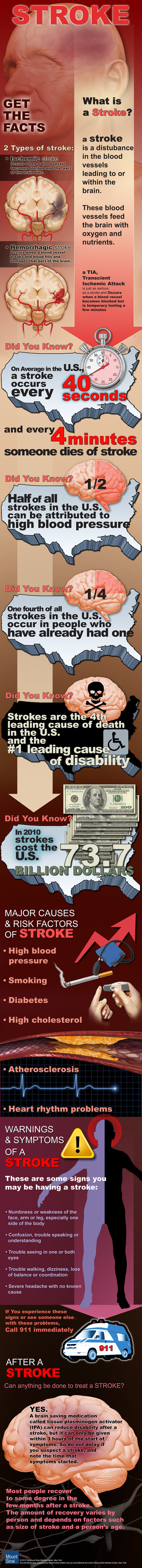 get-the-facts-on-stroke